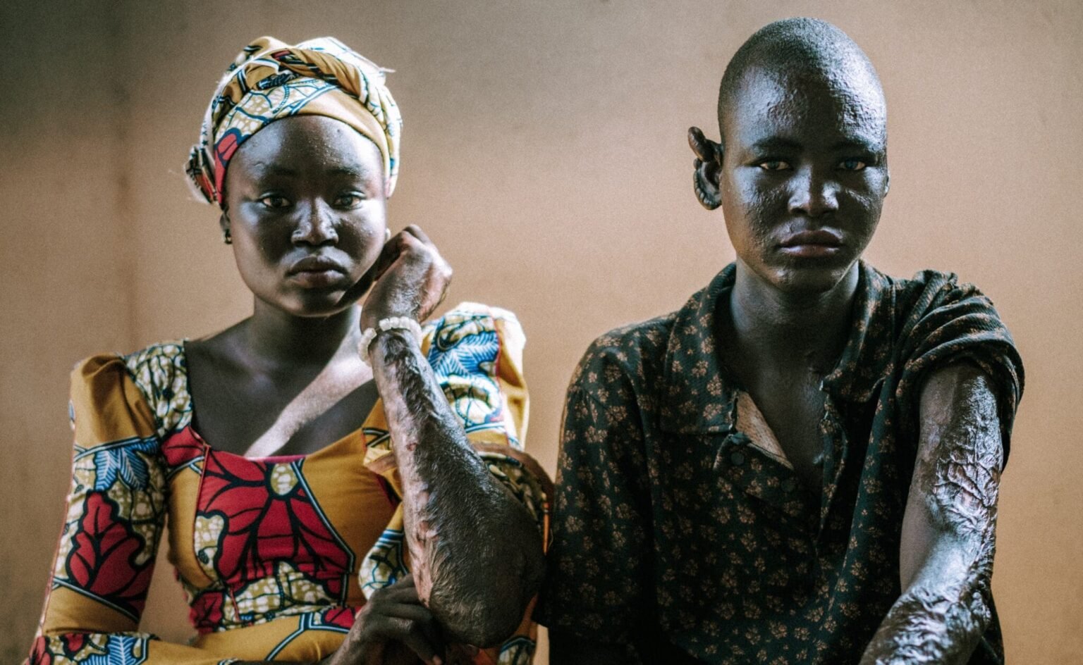 In Nigeria, Nancy and Philemon Forgive Their Attackers